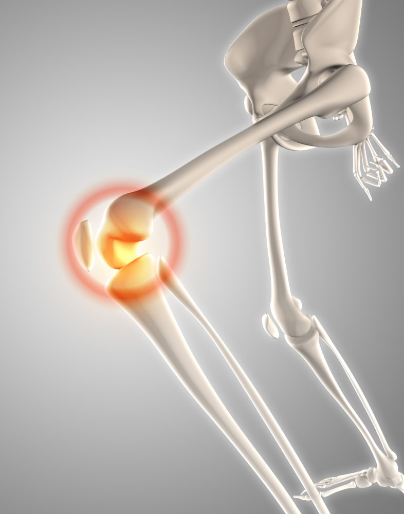 Orthopaedics (Joint Replacement)