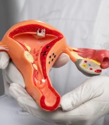 Gynaecology (Congenital Anomaly of Uterus)